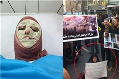 همسر جانبازی که روز گذشته خودسوزی کرد