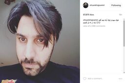 خواننده محبوبی که موهایش سفید شد!+ عکس