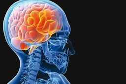هر 5 دقیقه یک ایرانی سکته مغزی می‌کند