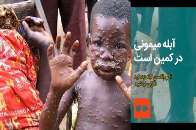 وزارت بهداشت برای جلوگیری از شیوع آبله میمون مبادی وردی کشور را رصد می‌کند