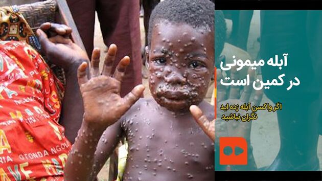 وزارت بهداشت برای جلوگیری از شیوع آبله میمون مبادی وردی کشور را رصد می‌کند
