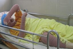 خودسوزی دختر آبی منجر به مرگ شد!