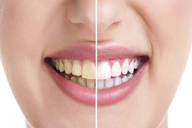 در روز چند بار مسواک بزنیم؟
