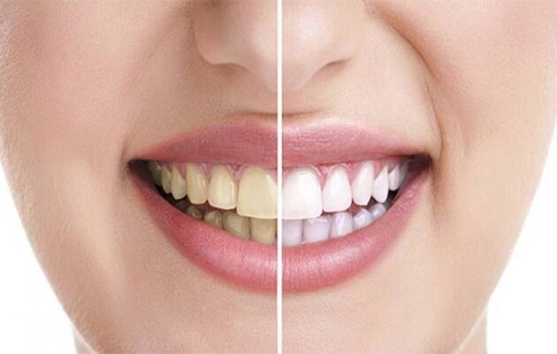 در روز چند بار مسواک بزنیم؟
