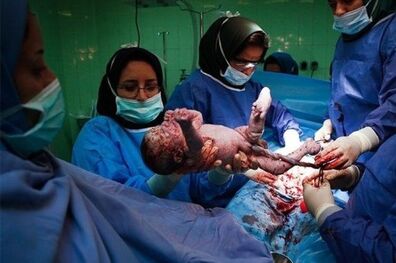 مادران باردار باید غربالگری های جنین را انجام دهند
