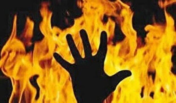  ۱۰۸ نفر به دلیل سوختگی در چهار ماهه امسال فوت کردند