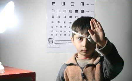 تنبلی چشم را در کودکی درمان کنید