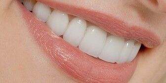 سن مناسب ارتودنسی چند سالگی است؟