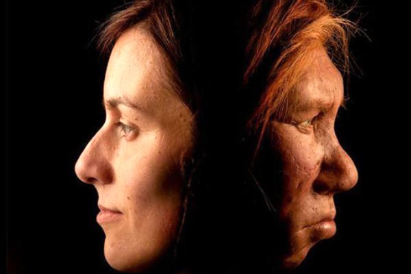 ژن نئاندرتال ها عامل اسکیزوفرنی و سل پوستی