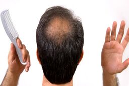 چند  ماده غذایی تقویت کننده مو را بشناسید 