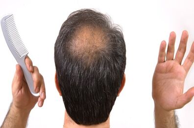 چند  ماده غذایی تقویت کننده مو را بشناسید 