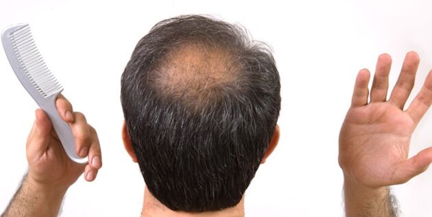 چند  ماده غذایی تقویت کننده مو را بشناسید 